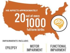 Philadelphia Birth Injury Lawyer