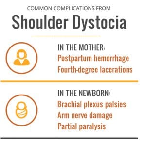 Shoulder Dystocia